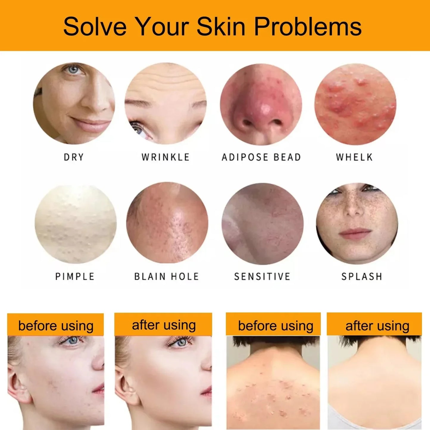 천연 귀리 비누 - OatPure 100g의 부드러운 브라이트닝 클렌징